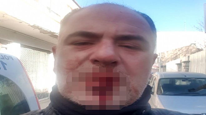 İzmir de gazeteciye darp iddiası