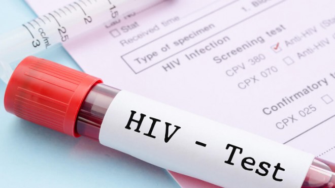 İzmir milletvekilinden flaş iddia: Kızılay ın kanından 3 hastaya HIV bulaştı!